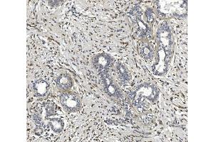 IHC analysis of CTHRC1 using anti-CTHRC1 antibody (ABIN7601256). (CTHRC1 antibody  (AA 31-243))