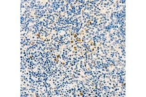 Immunohistochemistry (Paraffin-embedded Sections) (IHC (p)) image for anti-Baculoviral IAP Repeat Containing 3 (BIRC3) antibody (ABIN7073179)