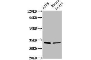 Western Blot Positive WB detected in: A375 whole cell lysate, Mouse heart tissue All lanes: TIMMDC1 antibody at 2. (TIMMDC1 antibody  (AA 444-585))