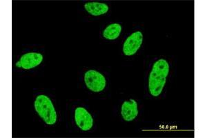 Immunofluorescence of monoclonal antibody to CDKL1 on HeLa cell. (CDKL1 antibody  (AA 259-358))