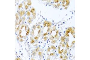 Immunohistochemistry of paraffin-embedded human stomach using TDGF1 antibody (ABIN3021341, ABIN3021342, ABIN3021343 and ABIN6214922) at dilution of 1:100 (40x lens). (TDGF1 antibody  (AA 1-188))