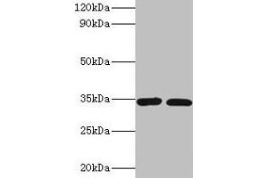 Western blot All lanes: CASP7 antibody at 2 μg/mL Lane 1: A549 whole cell lysate Lane 2: HGC-27 whole cell lysate Secondary Goat polyclonal to rabbit IgG at 1/10000 dilution Predicted band size: 35, 29, 38, 32 kDa Observed band size: 35 kDa (Caspase 7 antibody  (AA 24-198))
