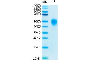 Human KIR2DL1 on Tris-Bis PAGE under reduced conditions. (KIR2DL1 Protein (His-Avi Tag))