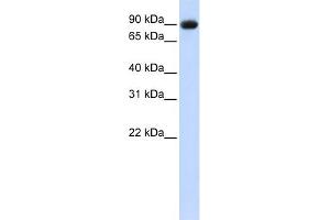 WB Suggested Anti-POSTN Antibody  Titration: 1 ug/ml Positive Control: 293T cells lysate (Periostin antibody  (Middle Region))