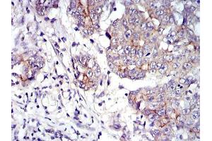 Immunohistochemistry (IHC) image for anti-Junction Plakoglobin (JUP) antibody (ABIN969225)