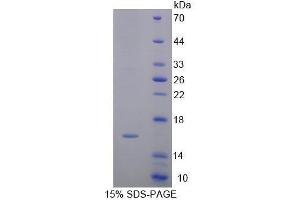 SDS-PAGE (SDS) image for Annexin A4 (ANXA4) (AA 35-157) protein (His tag) (ABIN1098867)
