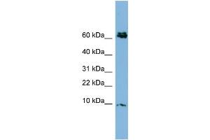 WB Suggested Anti-CRIP1  Antibody Titration: 0. (CRIP1 antibody  (N-Term))