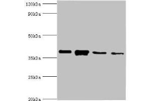 Western blot All lanes: Anxa1 antibody at 2 μg/mL Lane 1: PC-3 whole cell lysate Lane 2: A431 whole cell lysate Lane 3: K562 whole cell lysate Lane 4: MCF-7 whole cell lysate Secondary Goat polyclonal to rabbit IgG at 1/10000 dilution Predicted band size: 39 kDa Observed band size: 39 kDa (Annexin a1 antibody  (AA 2-346))