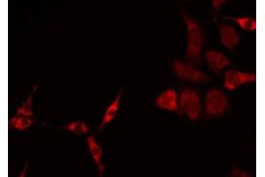 ABIN6275236 staining HeLa by IF/ICC. (MRPS27 antibody  (N-Term))