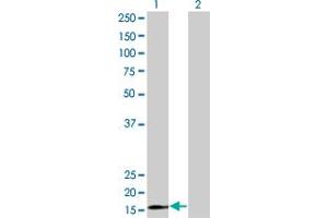 Western Blot analysis of RPS15 expression in transfected 293T cell line by RPS15 monoclonal antibody (M01), clone 4H8. (RPS15 antibody  (AA 77-145))