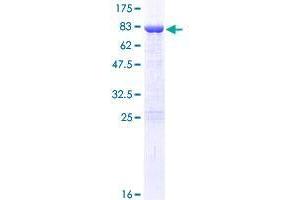 DDX19A Protein (AA 1-478) (GST tag)
