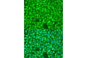 Immunofluorescence (IF) image for anti-Nuclear Factor of kappa Light Polypeptide Gene Enhancer in B-Cells 2 (NFKB2) (AA 690-899) antibody (ABIN3017388)