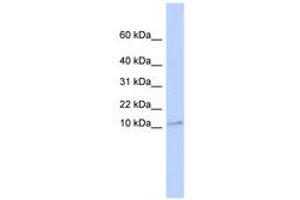 Image no. 1 for anti-Transmembrane Protein 93 (TMEM93) (N-Term) antibody (ABIN6740897)