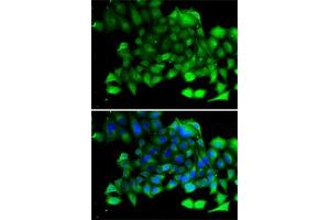 Immunofluorescence analysis of A-549 cells using CLIC4 antibody (ABIN6127638, ABIN6138723, ABIN6138724 and ABIN6222890). (CLIC4 antibody  (AA 1-253))