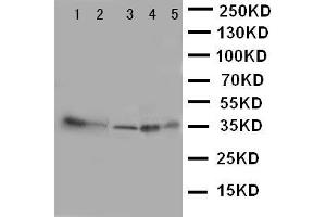 Anti-Annexin IV antibody, Western blotting Lane 1: Human Placenta Tissue Lysate Lane 2: Rat Liver Tissue Lysate Lane 3: 293T Cell Lysate Lane 4: HEPA Cell Lysate Lane 5: NIH3T3 Cell Lysate