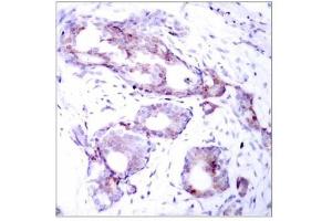 Image no. 1 for anti-Myc Proto-Oncogene protein (MYC) (pSer373) antibody (ABIN196676) (c-MYC antibody  (pSer373))