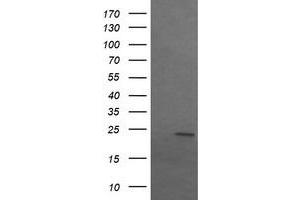 Image no. 2 for anti-Sex Determining Region Y (SRY) antibody (ABIN1501139) (SRY antibody)