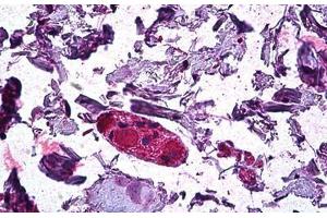 Human Colon, Ganglion: Formalin-Fixed, Paraffin-Embedded (FFPE) (DGAT1 antibody  (AA 217-229))