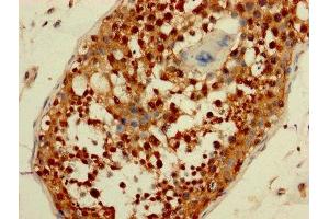 IHC image of ABIN7165006 diluted at 1:200 and staining in paraffin-embedded human testis tissue performed on a Leica BondTM system.