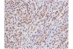 Immunohistochemistry (IHC) image for anti-Microtubule-Associated Protein tau (MAPT) (pSer235) antibody (ABIN6256205)