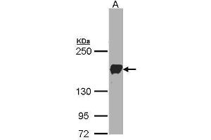 WB Image Sample(30 ug whole cell lysate) A:A431, 5% SDS PAGE antibody diluted at 1:1000 (Protocadherin 1 antibody)