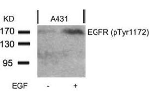 Image no. 2 for anti-Epidermal Growth Factor Receptor (EGFR) (pTyr1172) antibody (ABIN196960) (EGFR antibody  (pTyr1172))