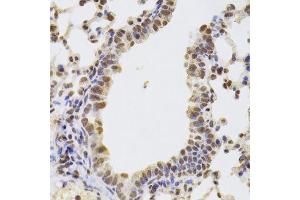 Immunohistochemistry of paraffin-embedded mouse lung using AAAS Antibody. (Adracalin antibody  (AA 287-546))