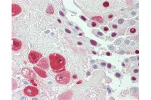 Anti-SERPINB2 / PAI-2 antibody IHC staining of human placenta.