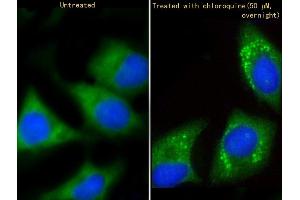Immunofluorescent analysis of 4 % paraformaldehyde-fixed, 0. (GABARAP antibody  (AA 1-30))