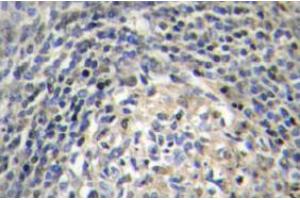 Image no. 2 for anti-Neutrophil Cytosol Factor 1 (NCF1) antibody (ABIN317896) (NCF1 antibody)