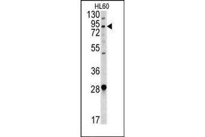 Image no. 1 for anti-Angiotensin I Converting Enzyme 2 (ACE2) (Center) antibody (ABIN358576) (ACE2 antibody  (Center))