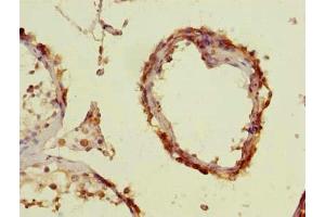 Immunohistochemistry of paraffin-embedded human testis tissue using ABIN7151794 at dilution of 1:100 (ENKD1 antibody  (AA 1-346))