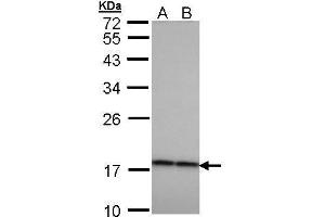 WB Image Sample (30 ug of whole cell lysate) A: H1299 B: HeLa 12% SDS PAGE antibody diluted at 1:1000 (CRYbA4 antibody)