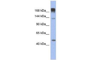 SLIT3 antibody used at 1 ug/ml to detect target protein.
