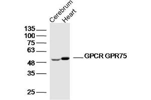 Lane 1: Mouse cerebrum lysates Lane 2: mouse heart lysates probed with GPCR GPR75 Polyclonal Antibody, Unconjugated  at 1:300 dilution and 4˚C overnight incubation. (GPR75 antibody  (AA 151-250))