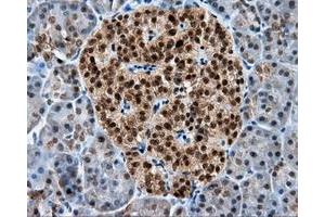 Immunohistochemical staining of paraffin-embedded liver tissue using anti-RALBP1 mouse monoclonal antibody.