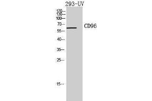Western Blotting (WB) image for anti-CD96 (CD96) (Internal Region) antibody (ABIN3181440) (CD96 antibody  (Internal Region))