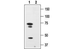 Western Blotting (WB) image for anti-Nerve Growth Factor Receptor (NGFR) (AA 188-203), (Extracellular) antibody (ABIN7043344)
