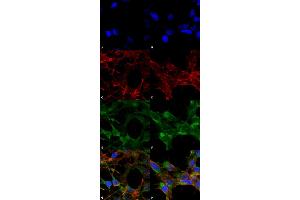 Immunocytochemistry/Immunofluorescence analysis using Mouse Anti-Acrolein Monoclonal Antibody, Clone 10A10 . (Acrolein antibody  (Biotin))