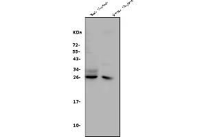 Western blot analysis of CD8 alpha/Cd8a using anti-CD8 alpha/Cd8a antibody (ABIN7601570). (CD8 alpha antibody  (AA 39-245))