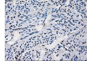 Immunohistochemical staining of paraffin-embedded Ovary tissue using anti-CYP2E1 mouse monoclonal antibody.