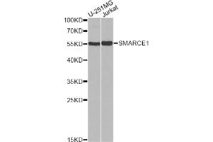Western blot analysis of extracts of various cell lines, using SMARCE1 antibody (ABIN5973097) at 1/1000 dilution. (SMARCE1 antibody)