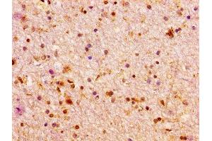 IHC image of ABIN7155649 diluted at 1:100 and staining in paraffin-embedded human brain tissue performed on a Leica BondTM system.