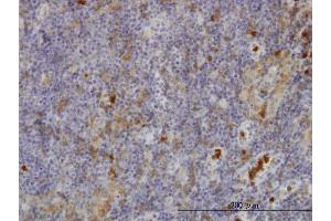 Immunoperoxidase of monoclonal antibody to FGR on formalin-fixed paraffin-embedded human lymph node. (Fgr antibody  (AA 1-90))