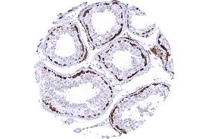Testis (Recombinant UCHL1 antibody)