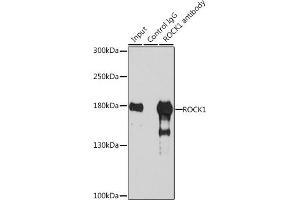 Immunoprecipitation analysis of 200 μg extracts of 293T cells, using 3 μg ROCK1 antibody . (ROCK1 antibody)