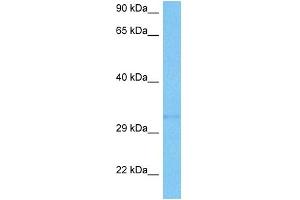 Host:  Mouse  Target Name:  SMN1  Sample Tissue:  Mouse Kidney  Antibody Dilution:  1ug/ml (SMN1 antibody  (N-Term))