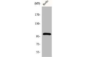 Western Blot analysis of HuvEc cells using Centrobin Polyclonal Antibody (CNTROB antibody  (Internal Region))