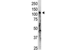 Western Blotting (WB) image for anti-2'-5' Oligoadenylate Synthetase 3 (OAS3) antibody (ABIN3002560) (OAS3 antibody)