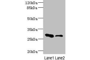 Western blot All lanes: EAF2 antibody at 3. (EAF2 antibody  (AA 1-170))